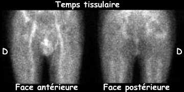 Temps tissulaire