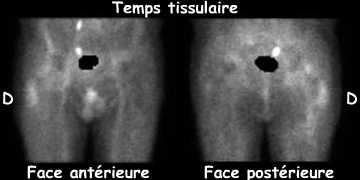 Temps tissulaire