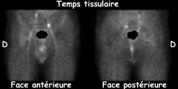 Temps tissulaire