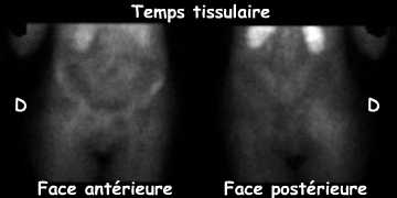 Temps tissulaire
