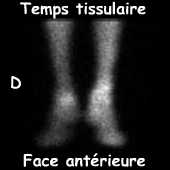 Temps tissulaire
