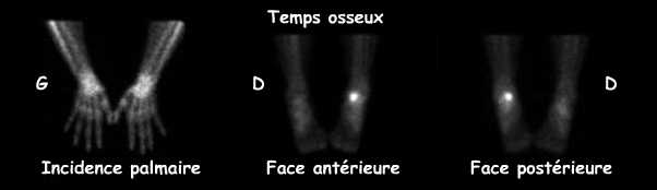 Temps osseux