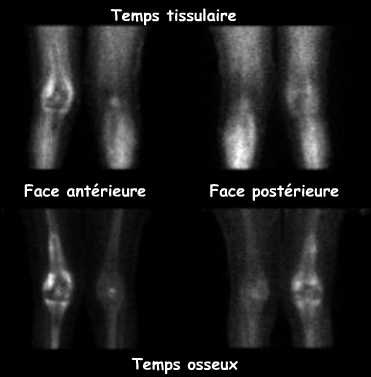 Temps tissulaire et temps osseux