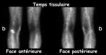 Temps tissulaire