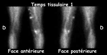 Temps tissulaire