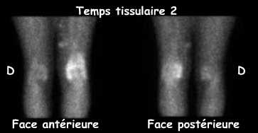 Temps tissulaire