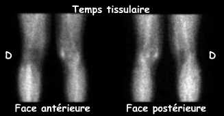 Temps tissulaire