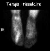 Temps tissulaire