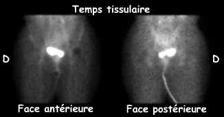 Temps tissulaire
