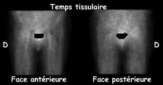 Temps tissulaire