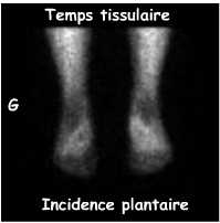 Temps tissulaire