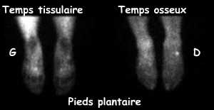Clich&eacute;s centr&eacute;s