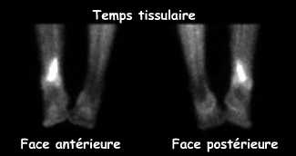 Temps tissulaire