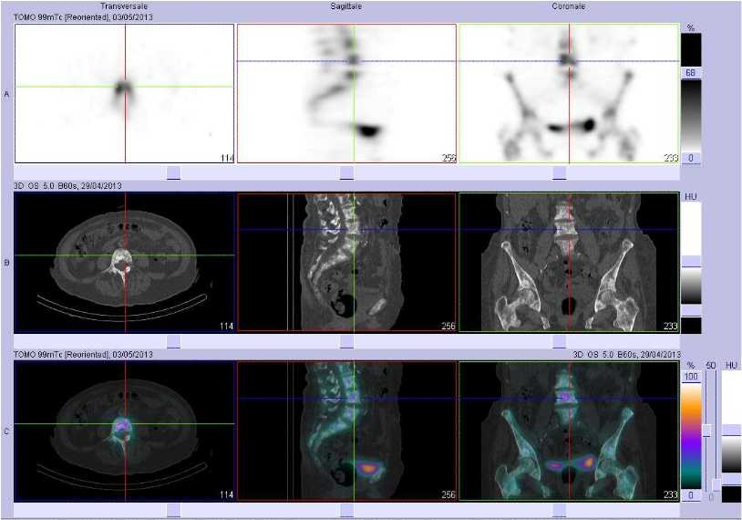 Superscan m&eacute;tastatique