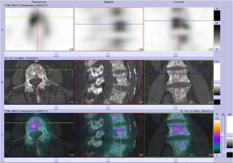 Superscan m&eacute;tastatique