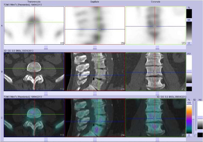 Superscan m&eacute;tastatique