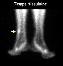Temps tissulaire