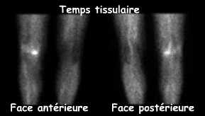 Temps tissulaire