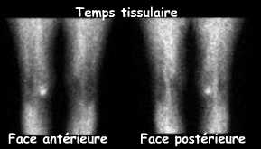 Temps tissulaire