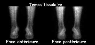 Temps tissulaire