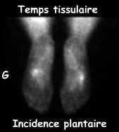 Temps tissulaire