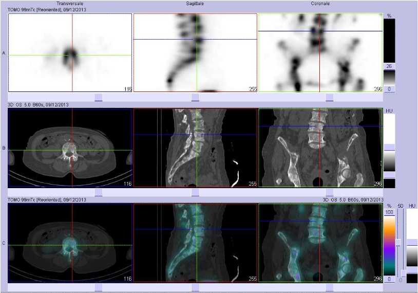 Superscan m&eacute;tastatique