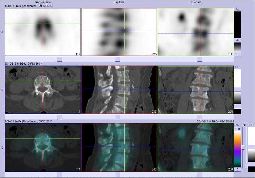 Superscan m&eacute;tastatique