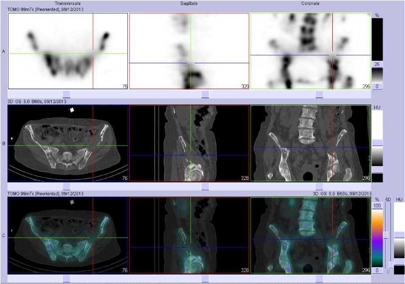 Superscan m&eacute;tastatique