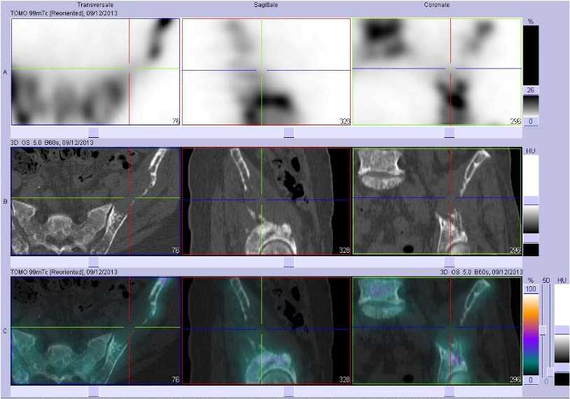Superscan m&eacute;tastatique