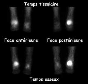 Clich&eacute;s centr&eacute;s