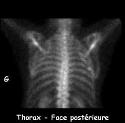 Clich&eacute; centr&eacute; sur le thorax