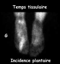 Temps tissulaire