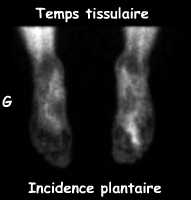 Temps tissulaire
