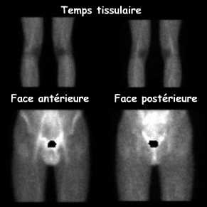 Temps tissulaire