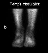 Temps tissulaire