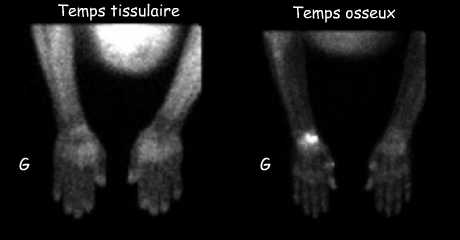 Temps tissulaire et temps osseux