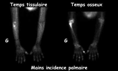 Temps tissulaire et temps osseux