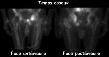 Temps osseux - Clich&eacute;s centr&eacute;s