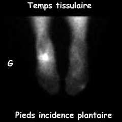 Temps tissulaire