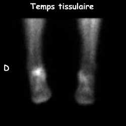 Temps tissulaire