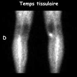 Temps tissulaire