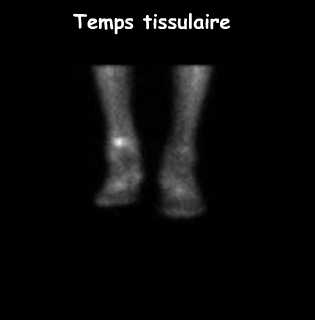 Temps tissulaire