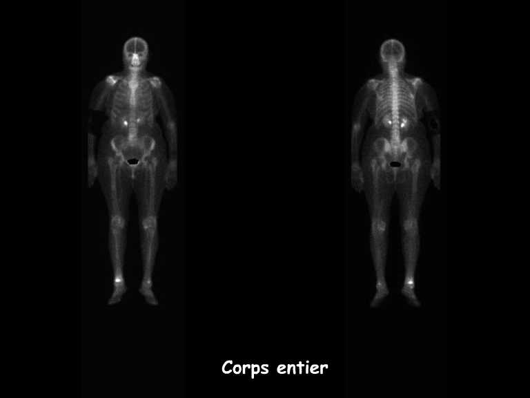 Corps entier