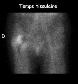 Temps tissulaire