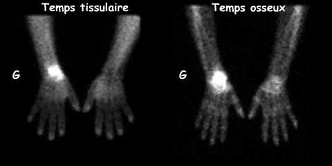 Temps tissulaire et temps osseux