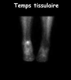 Temps tissulaire