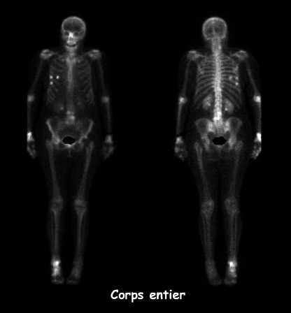 Corps entier