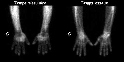Temps tissulaire et temps osseux