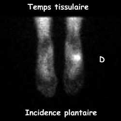 Temps tissulaire