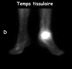 Temps tissulaire
